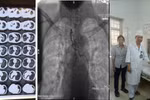 Những nỗ lực giành giật mạng sống từ tay tử thần