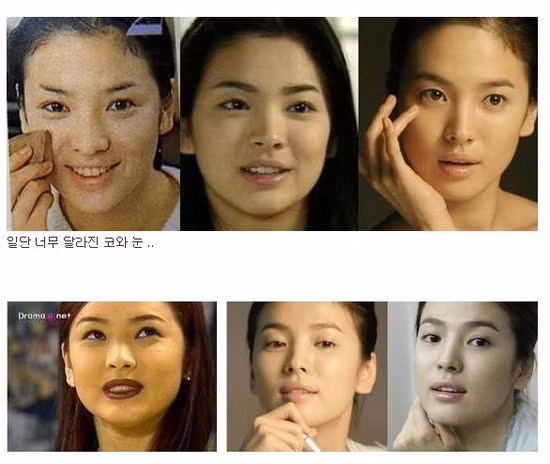 Được mệnh danh là "đệ nhất mỹ nữ" Hàn Quốc, nhưng trước đó Song Hye Kyo cũng đã từng một thời má ú môi thâm khiến mọi người đều không nhận ra. Được mệnh danh là "đệ nhất mỹ nữ" Hàn Quốc, nhưng trước đó Song Hye Kyo cũng đã từng một thời má ú môi thâm khiến mọi người đều không nhận ra.